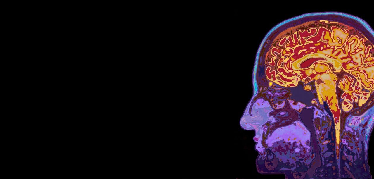 side image of a brain
